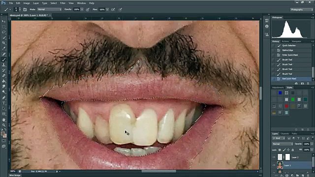 Franck Ribery sans cicatrice grâce à Photoshop