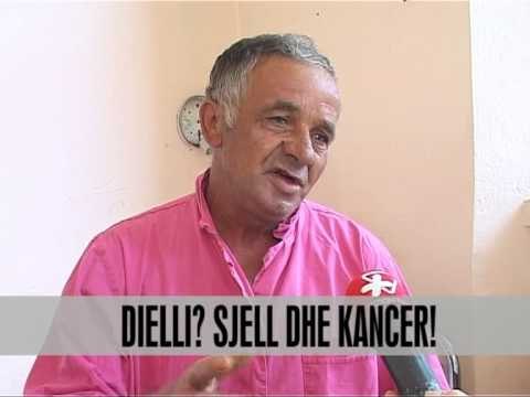 Kujdes nga dielli, shkakton kancer! - Vizion Plus - News, Lajme