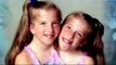 Conjoined Twins Abby and Brittany's New TLC - two head -