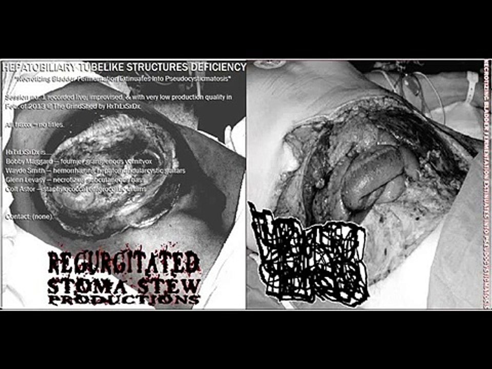 HEPATOBILIARY TUBELIKE STRUCTURES DEFICIENCY- demo CDr 1