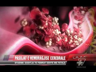 Pasojat e hemorragjisë cerebrale - News, Lajme - Vizion Plus
