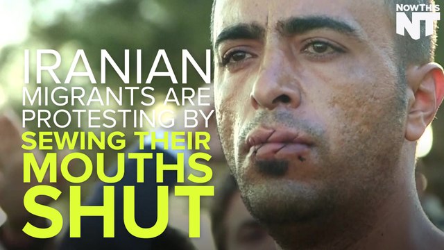 These Iranian Migrants Have Sewn Their Mouths Shut In Protest