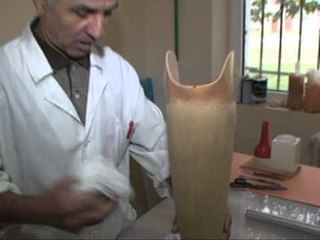 PROTEZAT E INVALIDEVE KUKES,SPITALI NUK KA FONDE PER RIPARIMIN E PROTEZAVE LAJM