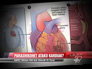 Studimi, a mund të parashikohet ataku kardiak? - News, Lajme - Vizion Plus