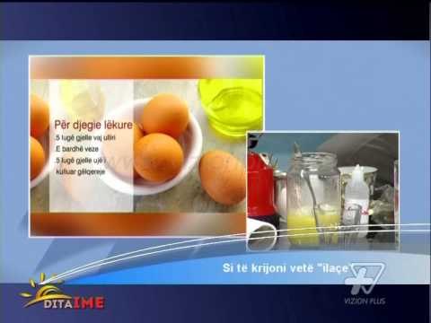 Dita Ime - Si te krijoni vete ilace - 28 Janar 2014 - Show - Vizion Plus