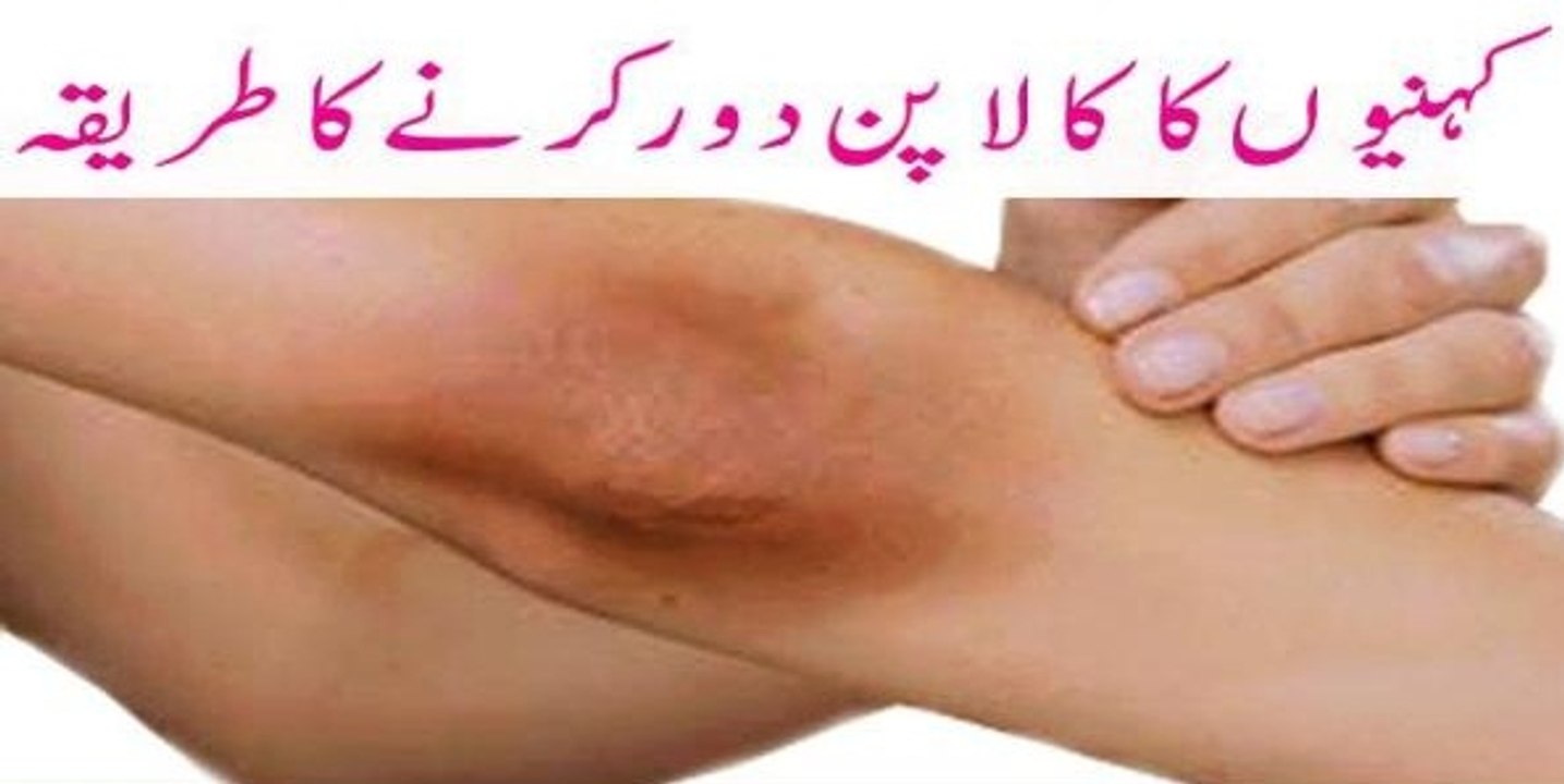 Get Whiter Knees in 24 hours