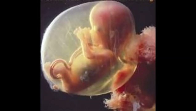 18 weeks pregnant, 18 weeks pregnant symptoms, 18 weeks pregnant ultrasound