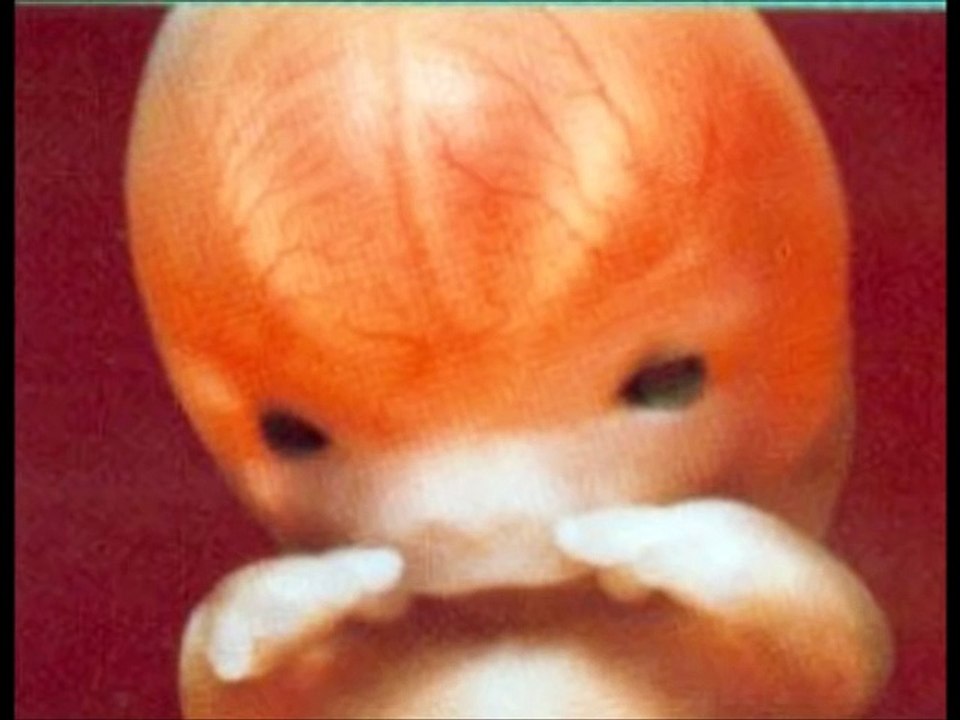 6 weeks pregnant, 6 weeks pregnant symptoms, 6 weeks pregnant belly