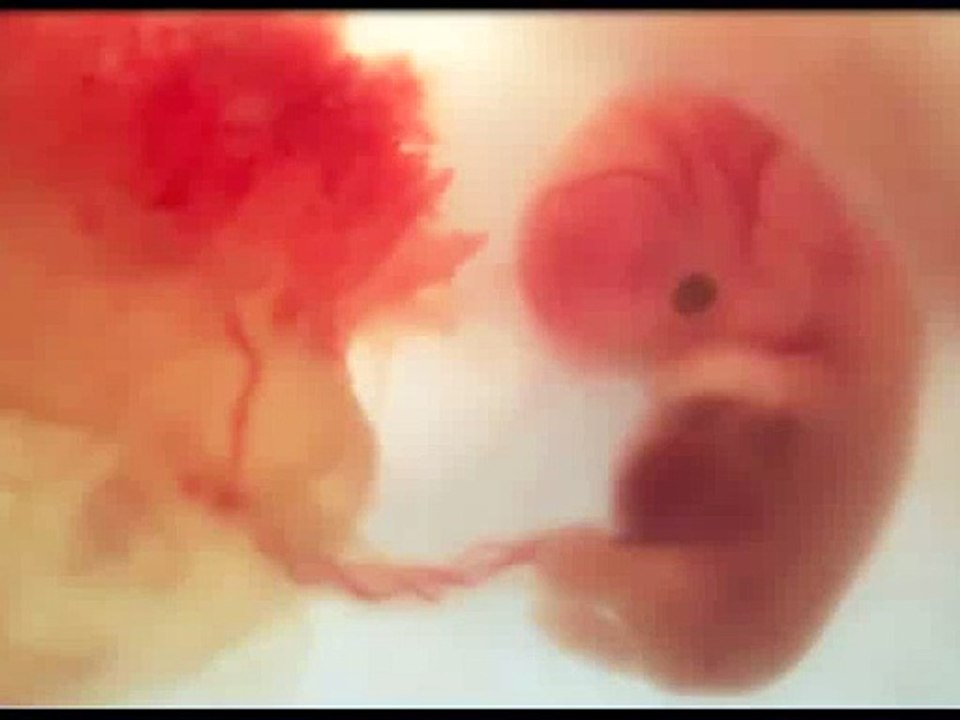 8 weeks pregnant, 8 weeks pregnant belly, 8 weeks pregnant pictures