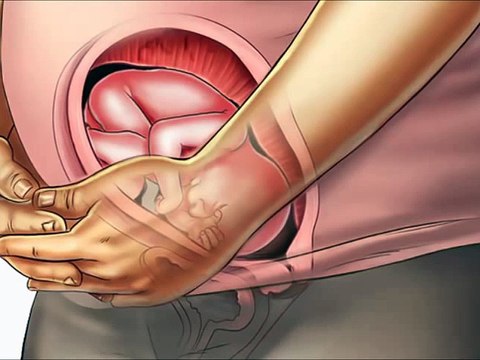 22 weeks pregnant, 22 weeks pregnant belly, 22 weeks pregnant with twins