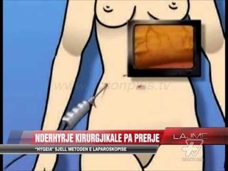 Nderhyrje kirurgjikale pa prerje - News, Lajme - Vizion Plus