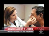Shkaku i kancerit te lekures - News, Lajme - Vizion Plus