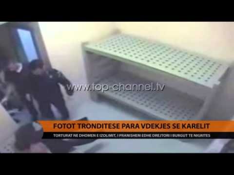 Fotot e dhunës ndaj Karelit - Top Channel Albania - News - Lajme