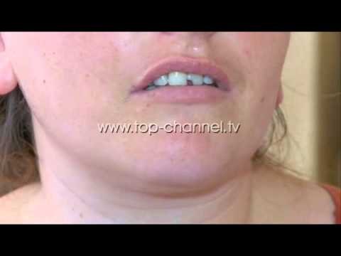 10 muaj pranë shtratit të vogëlushes sime - Top Channel Albania - News - Lajme