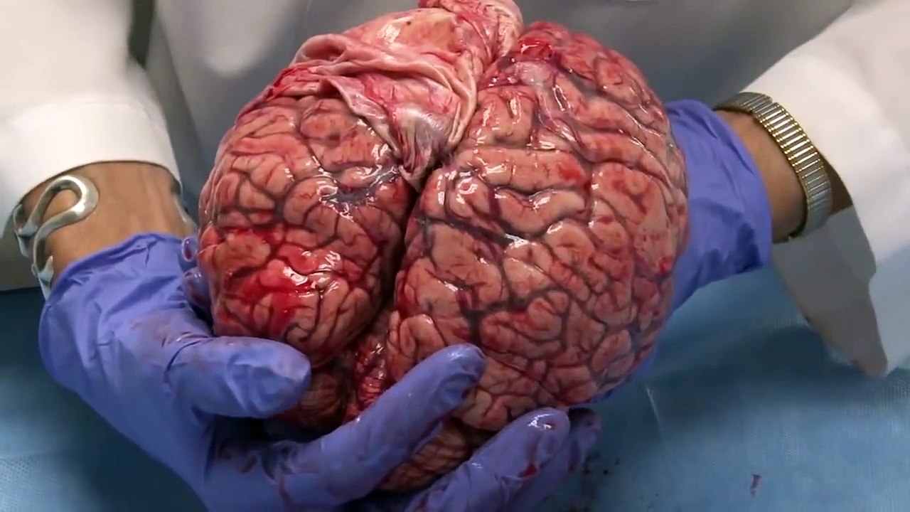 University of Utah Neuroscience Initiative