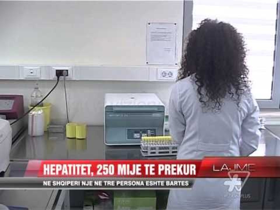 Hepatitet, 250 mije te prekur - News, Lajme - Vizion Plus