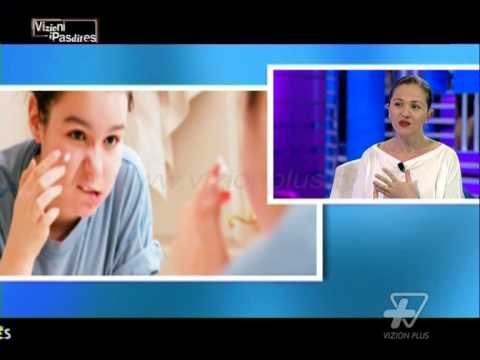 Vizioni i Pasdites - Aknet, trajtimi gjate veres - 31 Korrik 2014 - Show - Vizion Plus