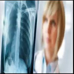 mesothelioma lawsuits
