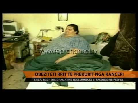 Obeziteti, i lidhur me sëmundjet kancerogjene - Top Channel Albania - News - Lajme