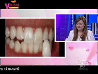 Tải video: Vizioni i pasdites - Kujdesi dentar - 30 Shtator 2014 - Show - Vizion Plus