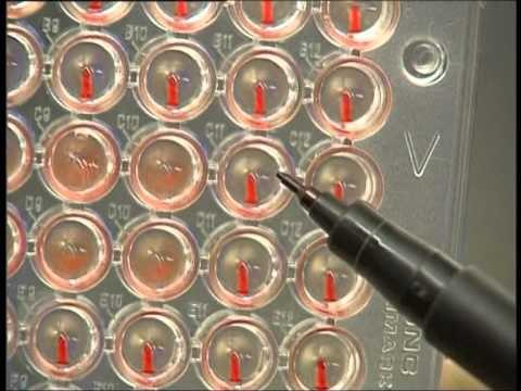 SIPAS SHKENCETAREVE BRITANIKE VIRUSI “HIV” PO DOBESOHET E PO BEHET ME PAK VDEKJEPRURES LAJM