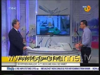 Wake Up, 2 Dhjetor 2014, Pjesa 2 - Top Channel Albania - Entertainment Show