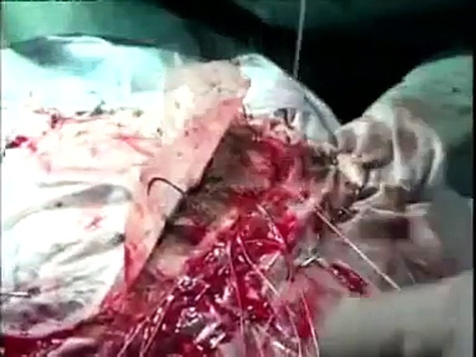 UTSWNerurozone Video Viewer