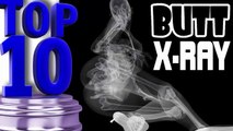 TOP 10 ● Butt & Ass X-Ray | Radios Chocs Des Fesses Et Intestins ► Youclip.fr