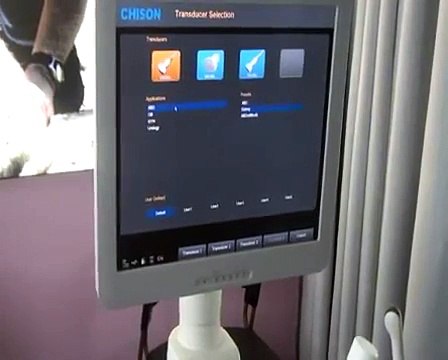 Color Doppler Ultrasound Chison Q5 | 4D Video Training Volumetric Probe
