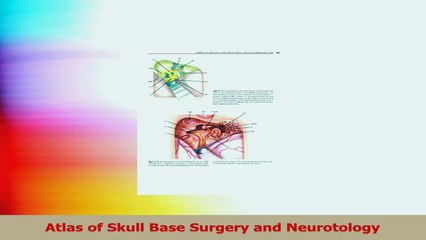 Atlas of Skull Base Surgery and Neurotology Read Online