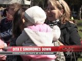 Dita Ndërkombëtare e sindromës Down - News, Lajme - Vizion Plus
