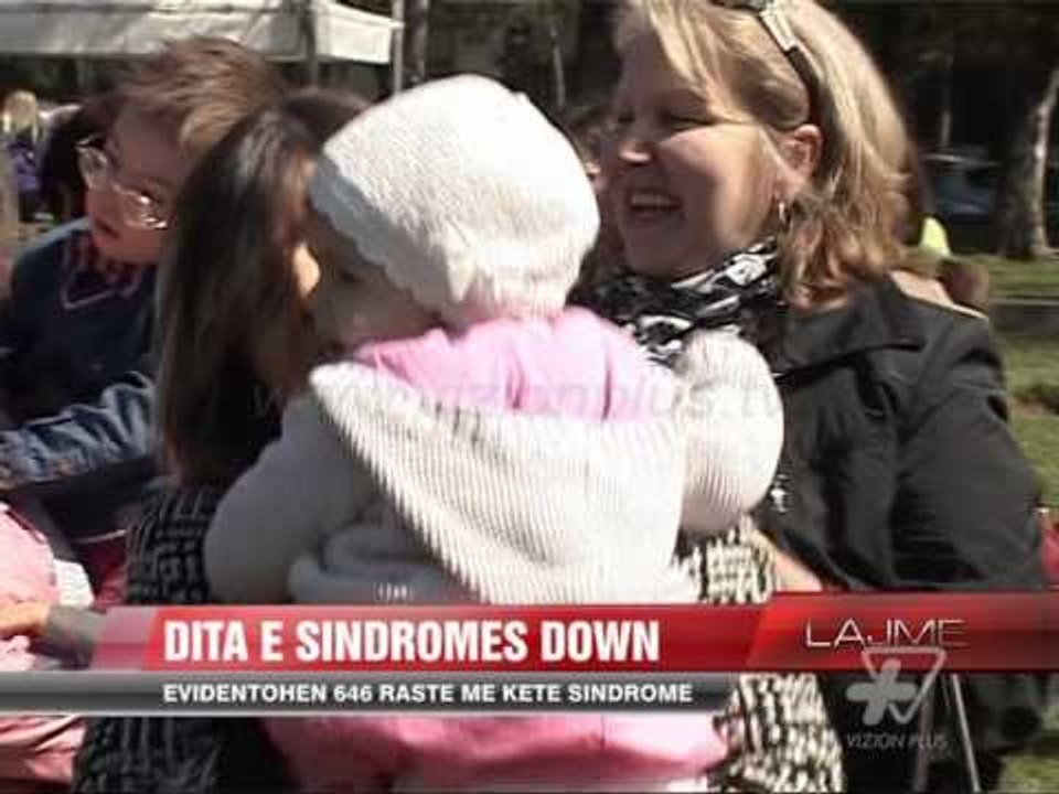 Dita Ndërkombëtare e sindromës Down - News, Lajme - Vizion Plus