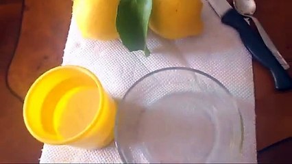 How to whiten EXTREMELY yellow teeth at home (with actual pictures)