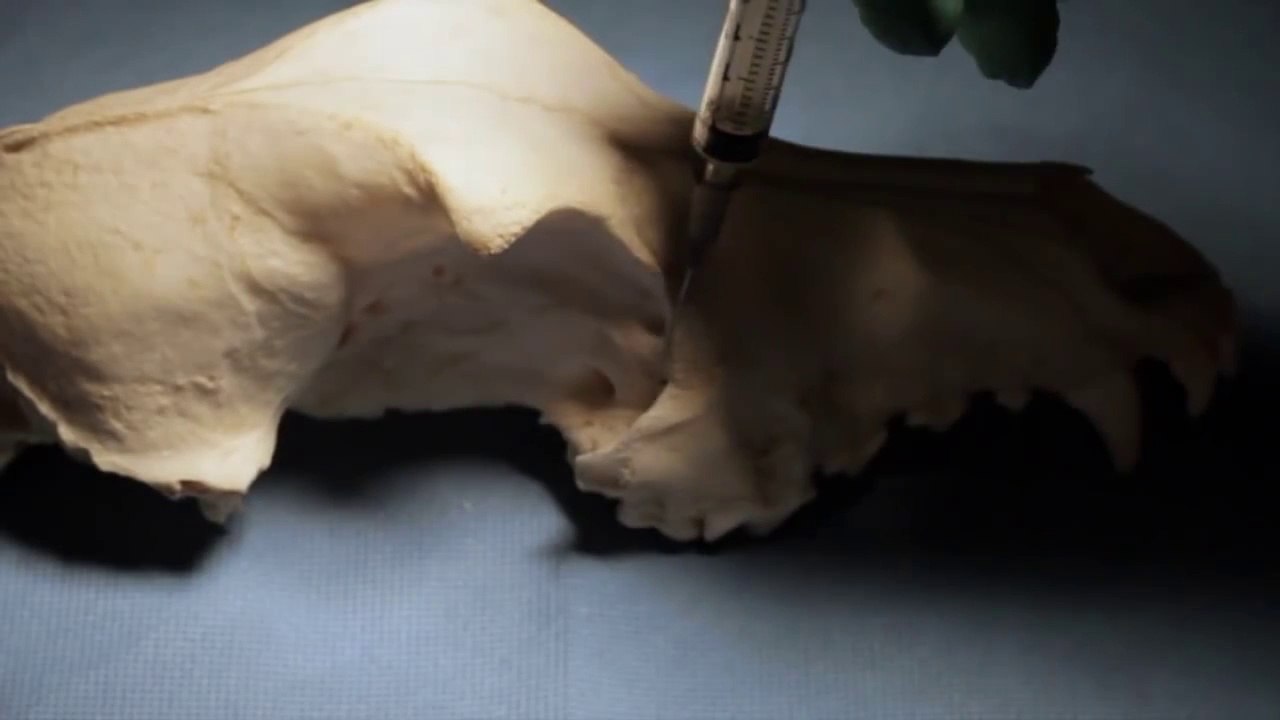 Veterinary Dentistry - Pain Evaluation Post Maxillectomy in a Dog