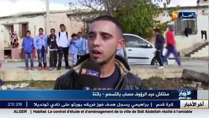 باتنة   ميكروب مجهول المصدر يتسبب في تسمم أكثر من 50 شخصا