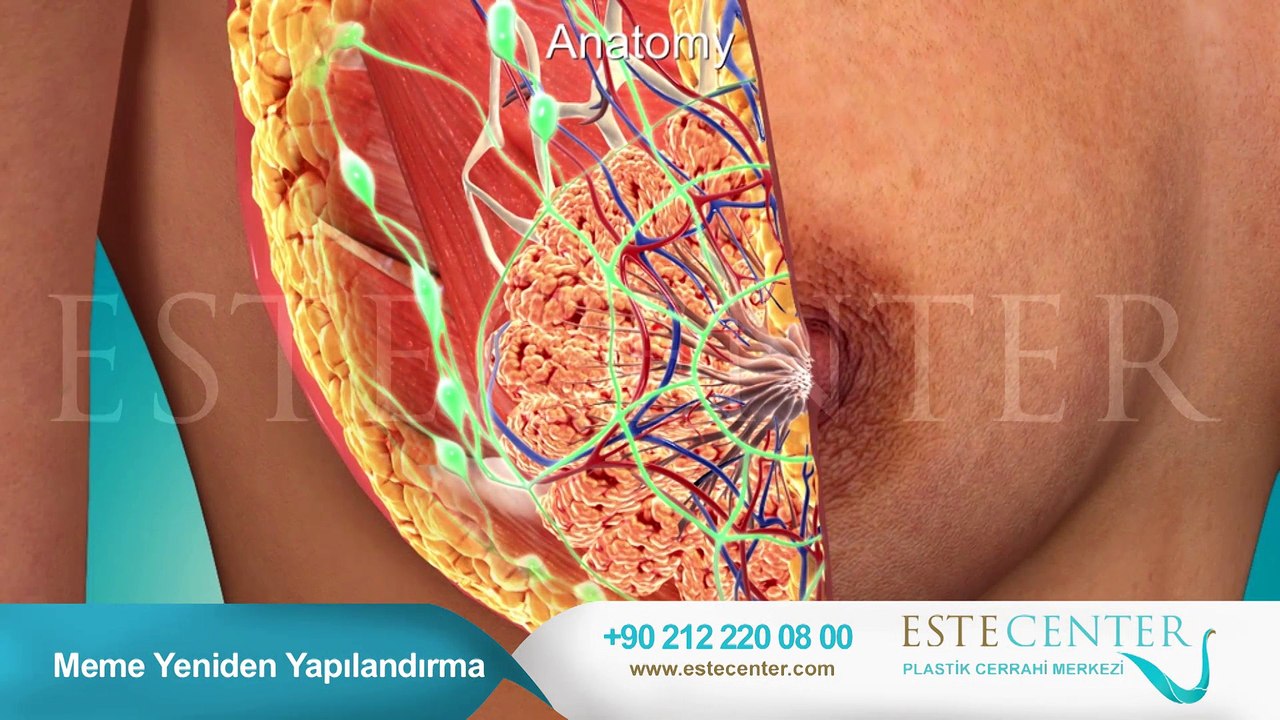 Meme Aldırma ve Yeniden Yapılandırma Ameliyatı (Animasyon)