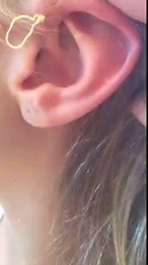 Elle perce un bouton à l'oreille vieux de 6 ans... Beurk !!