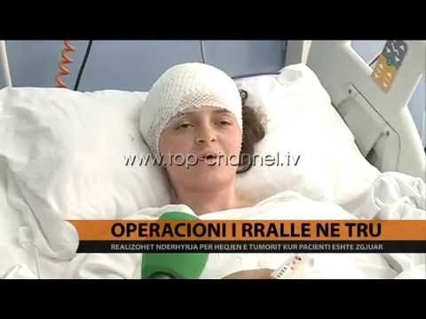 Operacioni i rrallë në tru - Top Channel Albania - News - Lajme