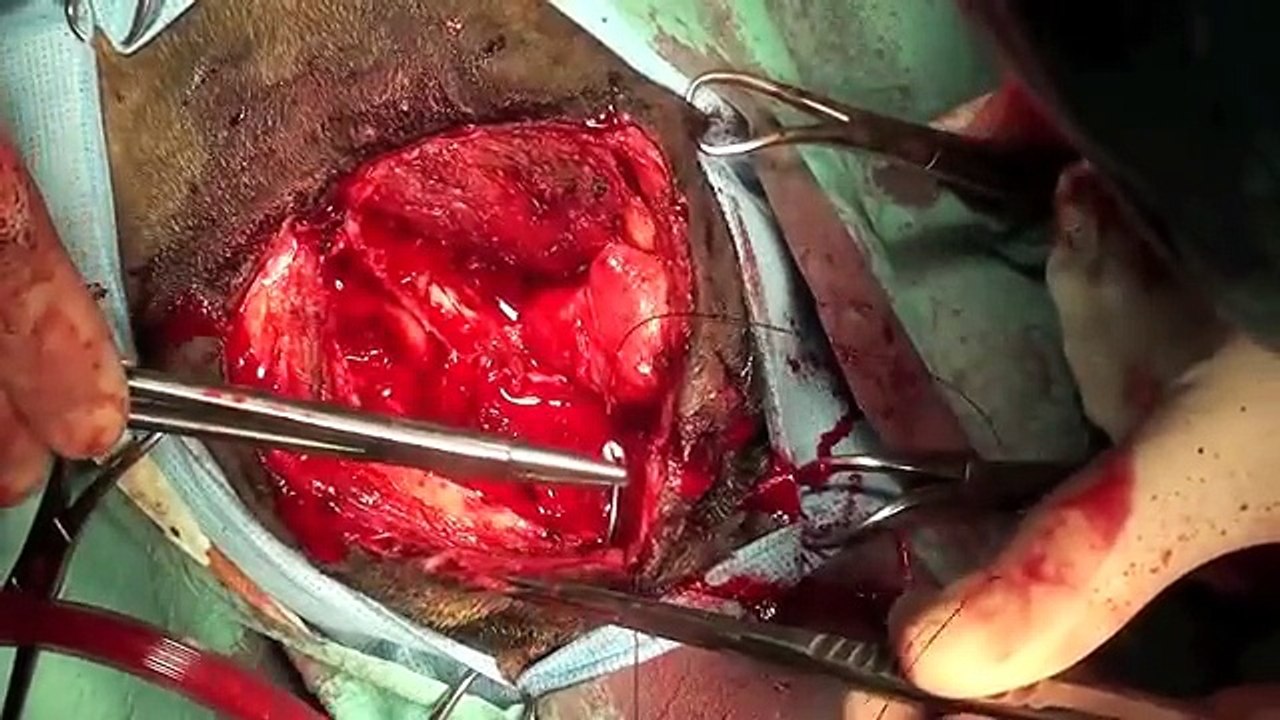 Surgical Procedures