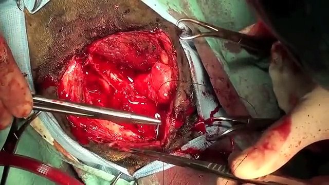 Surgical Procedures