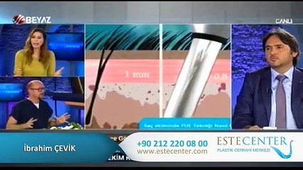 İbrahim Çevik Beyaz TV'de Saç Ekimini Anlatıyor