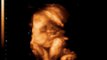 3D and 4D ultrasounds imaging Lehi,UT -4 LIVE