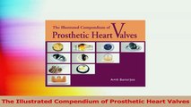 The Illustrated Compendium of Prosthetic Heart Valves PDF