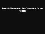 Prostatic Diseases and Their Treatments: Patient Pictures Read Online