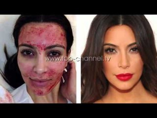 Bukuri klinike, apo në kushte shtëpiake? - Top Channel Albania - News - Lajme