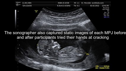 Ce qu'il se passe lorsqu'on fait craquer ses doigts