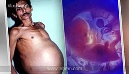Unbelievable and Amazing | Man Born a Baby in India