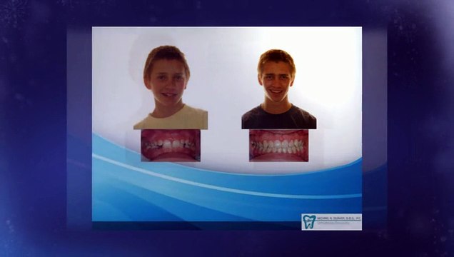 Orthodontics Littleton - Dr. Duryea - (303) 933-0300