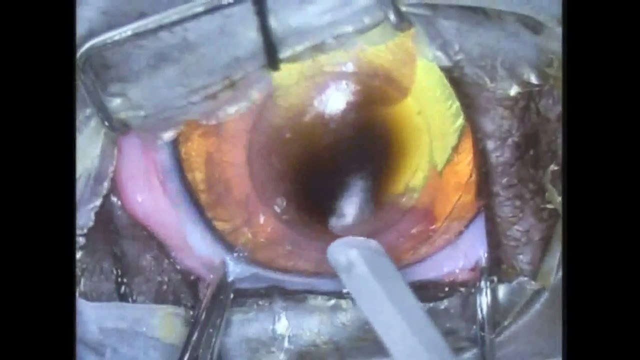 Vetrix