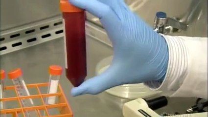How It's Made Regenerative Medicine